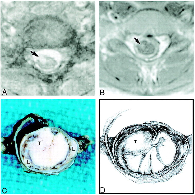 fig 3.