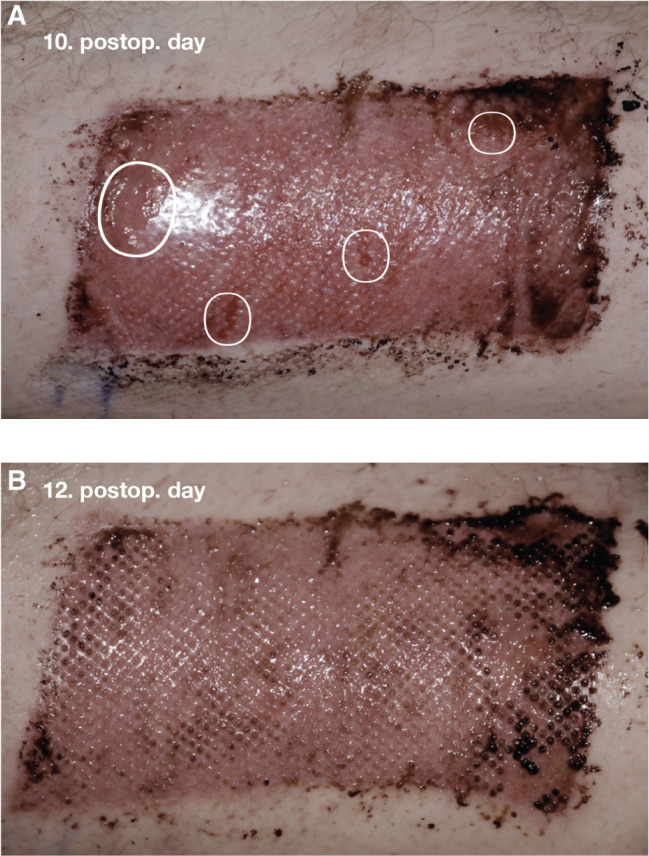 IWJ-12698-FIG-0003-c