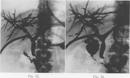Figs, 15 and 16.