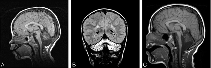 Fig 3.