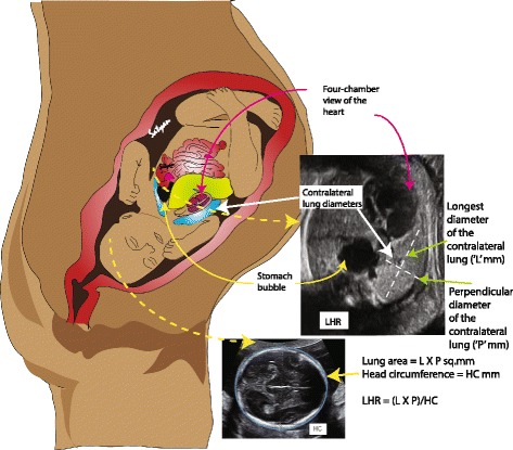 Fig. 6