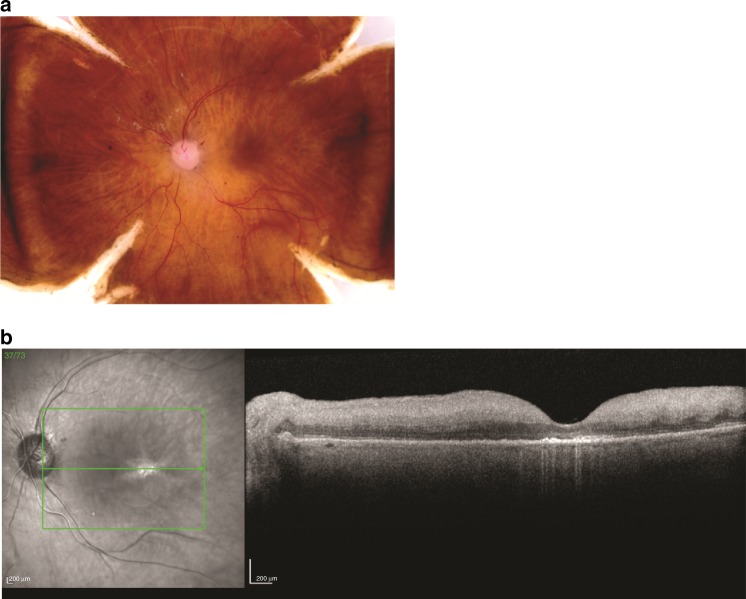 Fig. 1