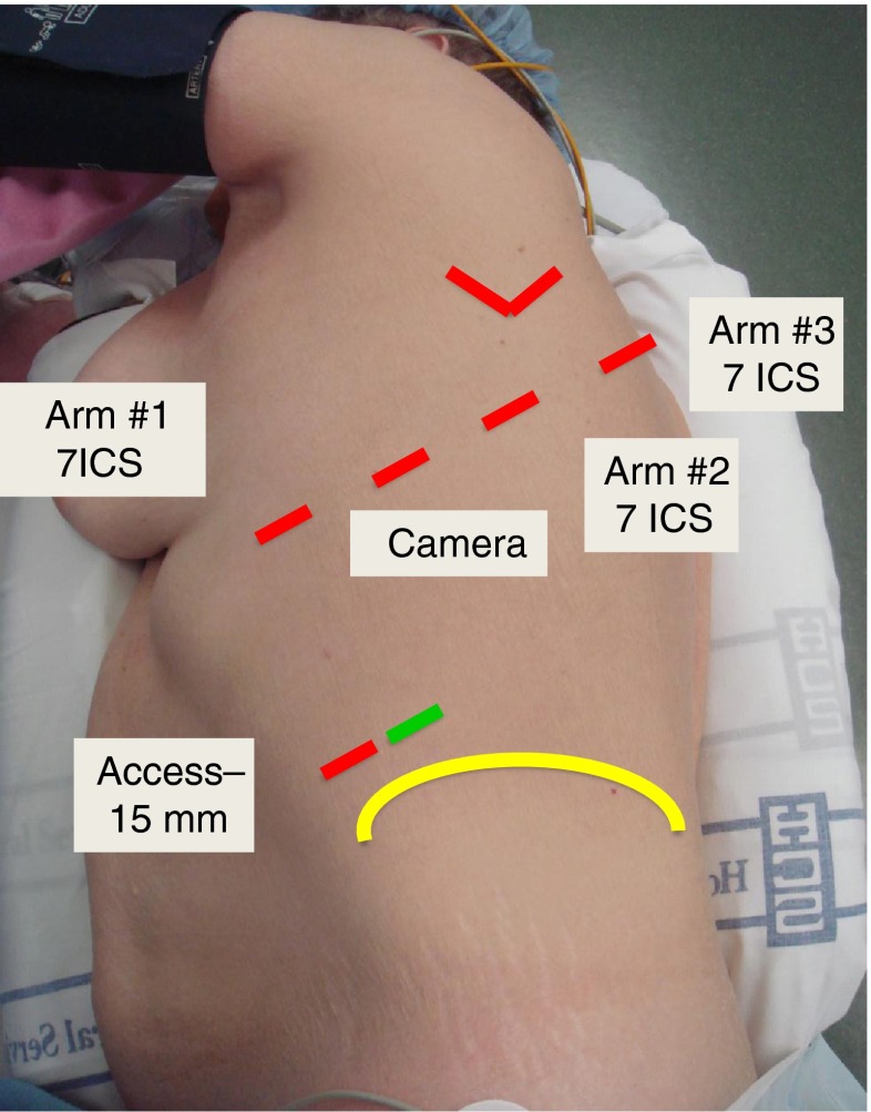 Fig. 3