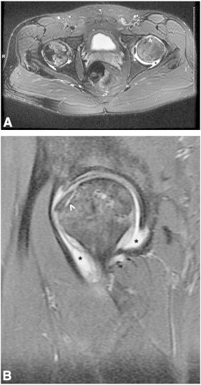 Fig 3