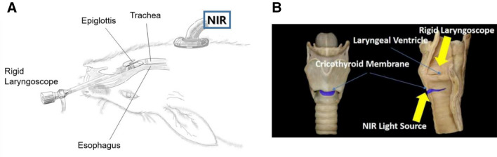 Fig. 3