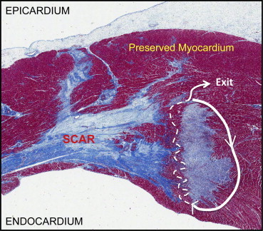 Fig. 1