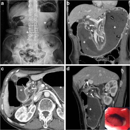 Fig. 11