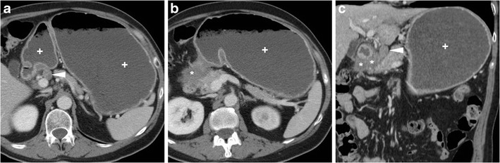 Fig. 13