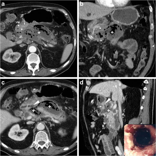 Fig. 16