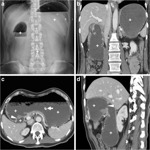 Fig. 15