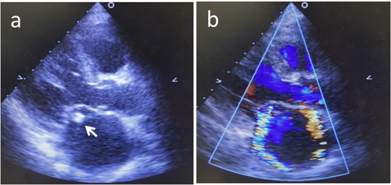 Fig. 1