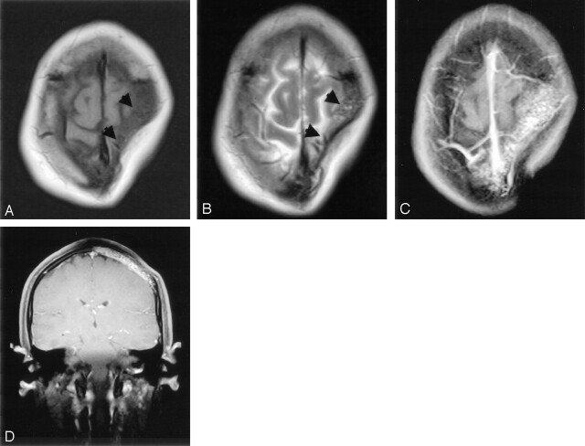 Fig 2.