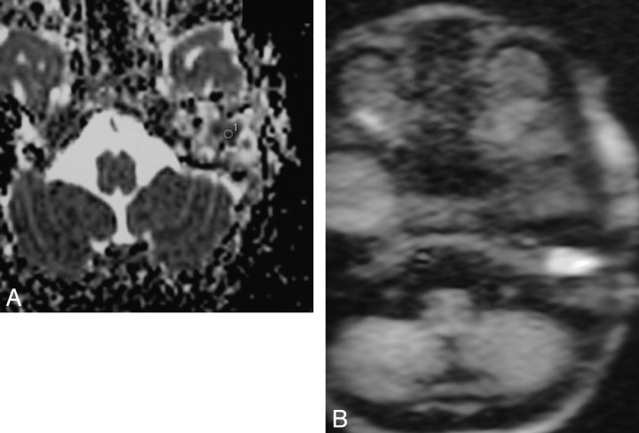 Fig 4.