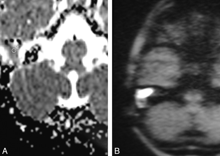 Fig 2.