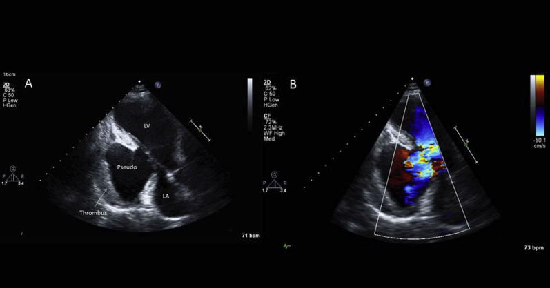 Figure 3