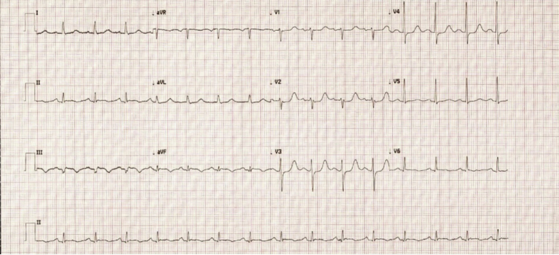 Figure 1