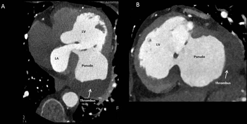 Figure 4