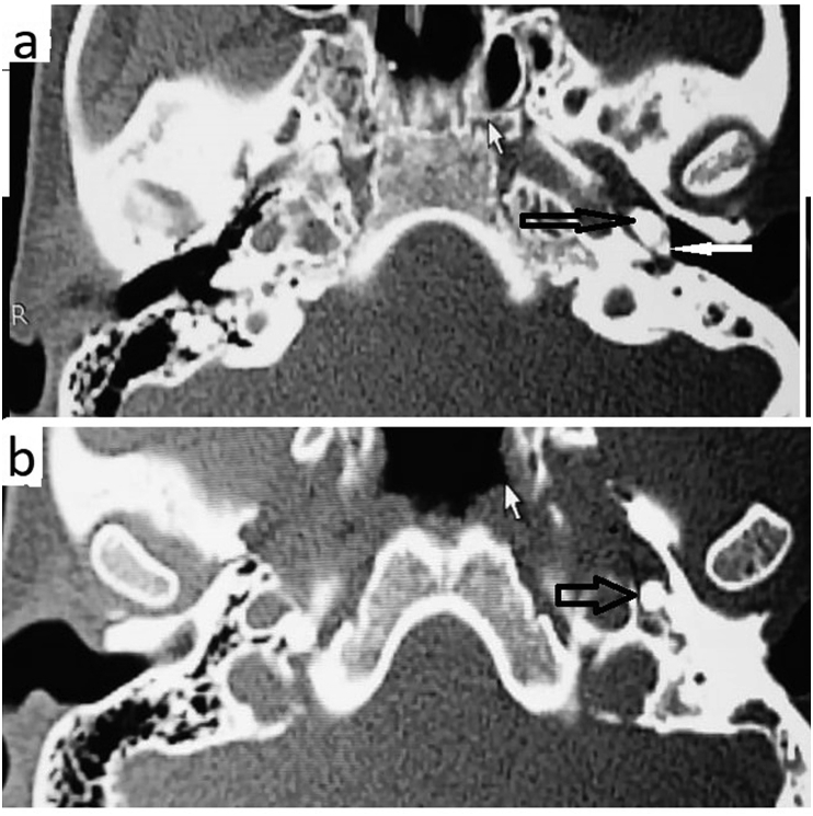 Fig. 3