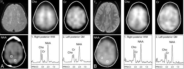 Fig 3.