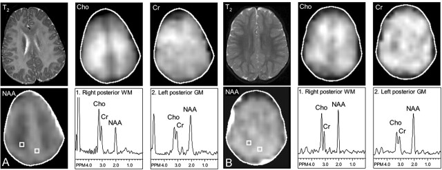 Fig 2.