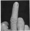 965