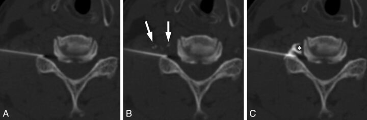 Fig 3.