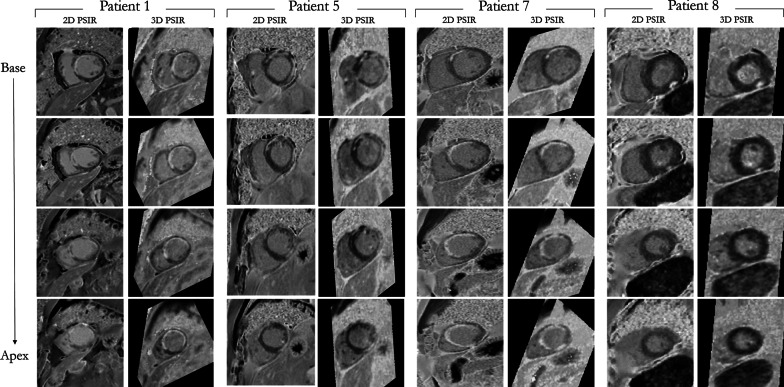 Fig. 4