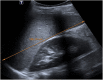 Figura 9