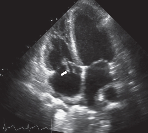 Figure 3)