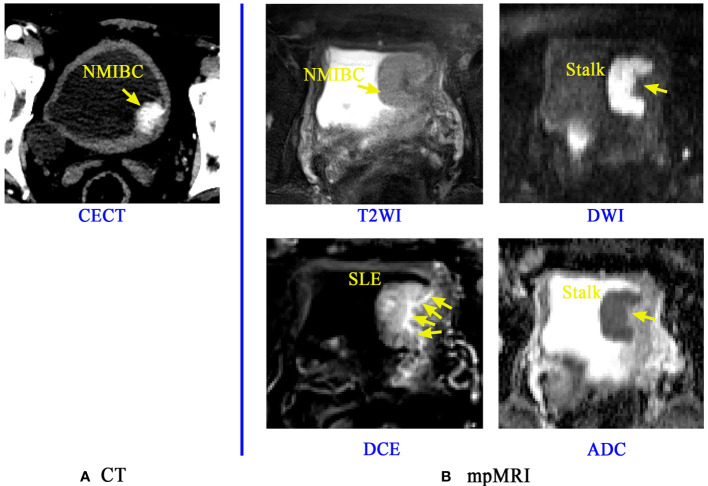 Figure 1