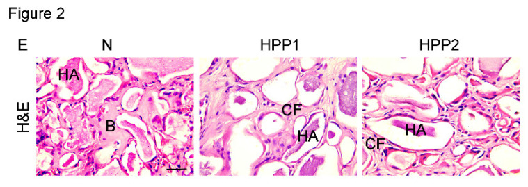 Figure 2E