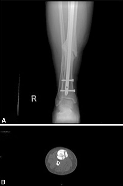 Fig. 3A–B