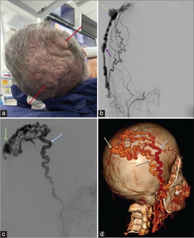 Figure 1: