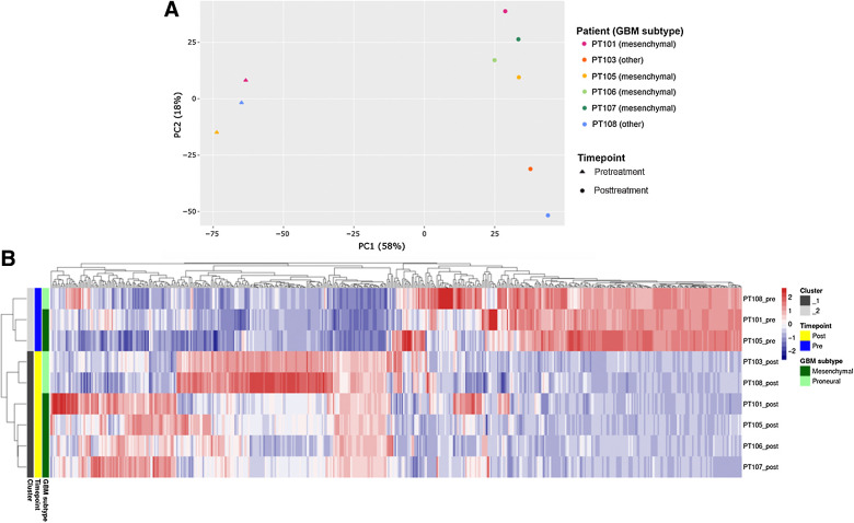 Figure 2. PCA and hierarchical clustering of RNA-seq gene expression values is driven by G207 treatment in pre- and posttreated biopsies. A, The top 500 most variable protein-coding genes were used to perform unsupervised PCA. Samples are colored by clinical trial identifiers while shapes designate timepoint relative to G207 treatment. B, Unsupervised hierarchical clustering of RNA-seq expression values, using the topmost 500 variable genes between all samples. Each column represents a gene, while rows represent individual samples. Color legend represents the log2 calculated relative expression scaled per column (gene). Sample annotations are displayed on left and include cluster ID (based on hierarchical clustering), treatment timepoint (pre- or post-G207), and GBM tumor subtype.