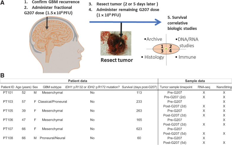 Figure 1. Overview of the G207 clinical trial design and patient demographics. A, Phase Ib-enrolled patients were treated with a fractional G207 dose [15% of the recommended phase II dose (RP2D)] after biopsy confirmation of malignant GBM recurrence based on histopathology. Patients then underwent tumor resection 2 or 5 days later and had the remaining G207 RP2D dose injected into the margins of the resection cavity. The resected G207-treated tumor samples were then divided and analyzed as shown in the schematic. Our manuscript focuses specifically on RNA studies. B, Summary of patient clinical trial identifiers, GBM tumor subtype, IDH1/2 hotspot mutational status, survival post-G207 treatment (in days), and available samples for our study. Timepoint of when the sample was taken is shown as 2 or 5 days (‘d’) post-treatment. “X” indicates available data for RNA-seq and/or NanoString gene expression assays. PFU, plaque-forming units.