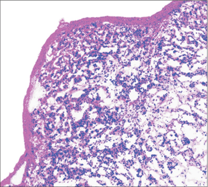 Methods of Hematoxylin and Erosin Image Information Acquisition and ...