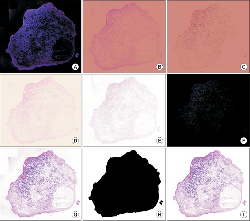 Methods of Hematoxylin and Erosin Image Information Acquisition and ...