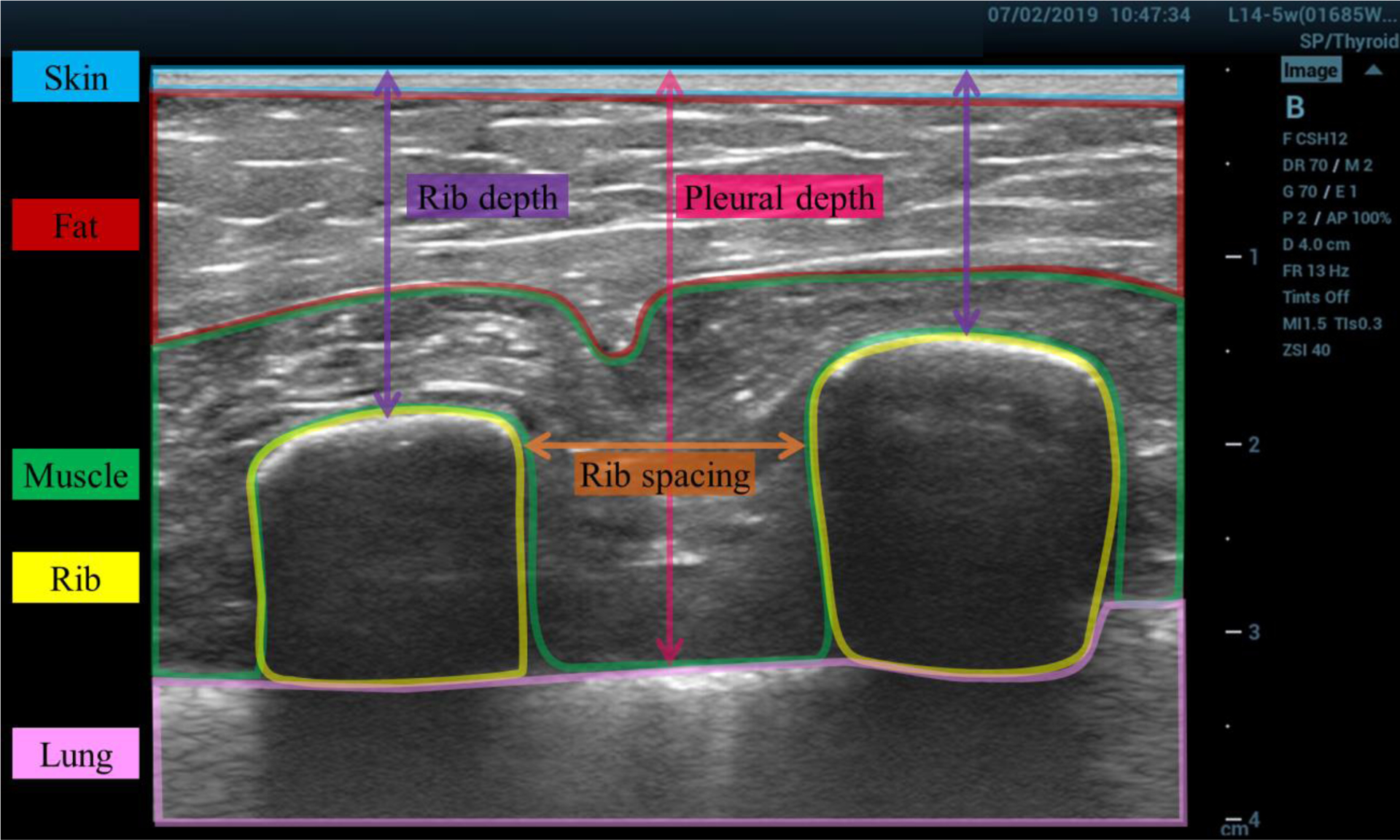 Figure 1: