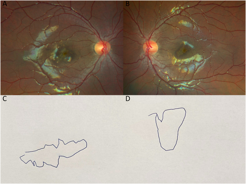 Fig. 3