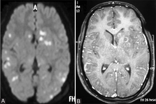 Figure 2(A and B)