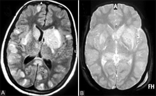 Figure 1(A and B)