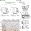 Figure 5. ONC201 in combination with paxalisib is a synergistic drug combination in DIPG xenograft models. A, SU-DIPG-VI/Luc and HSJD-DIPG-007 cells were injected into the brainstem of NSG mice. Treatment was started at 4 or 3 weeks, respectively, from xenograft date. ONC201 and paxalisib were administered by oral gavage. Xenografts were sacrificed for pharmacodynamics and survival was tracked where they were culled at ethical endpoints. B and C, Survival curve analysis of days after treatment start at animal sacrifice, with significance determined by survival curve comparison for SU-DIPG-VI/Luc (B) and HSJD-DIPG-007 (C). Shading indicates treatment duration. Log-rank (Mantel–Cox) test. D, Tumor tissue from SU-DIPG-VI/Luc xenografts sacrificed at 2 weeks following start of treatment analyzed by Western blot. E, SU-DIPG-VI/Luc in vitro cells exposed to 5 μmol/L ONC201 for 0, 24, 48, and 72 hours compared with in vivo SU-DIPG-VI/Luc tissue collected from the prefrontal cortex (PFC) and brainstem (BS), treated with ONC201. E, Tumor tissue was resected from HSJD-DIPG-007 xenografts following 4 weeks of treatment and analyzed by IHC. F, Sections were stained for H3K27M, Ki67, and SDHA (representative images are presented). Scale bars, 2 mm, 200 or 50 μm. G, IHC images quantified via ImageJ (measured in technical triplicate, across biological replicates, n = 3). *, P < 0.05; **, P < 0.01; ***, P < 0.001; ****, P < 0.0001; ns, not significant. b.i.d., twice daily; q.w., once a week; t.i.w., three times a week.
