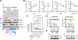 Figure 2. Pharmacoproteogenomic analysis identifies DRD2 and ClpP as targets of ONC201 in DIPG. A, Western blot analysis of basal DRD2, SDHA, and CLPP expression across DIPG models. B, Densitometry of protein expressions was normalized to DIPG-VUMC10 and compared with the z-AUC (median AUC) for the control cell lines (HMC3, HCMEC/D3, ReN)—AUC of DIPG cells after exposure to ONC201. Pearson linear regression, accounting for replicates, was used to determine ONC201 sensitivity correlation for DRD2, CLPP, SDHA, and the ratio of SDHA to CLPP (SDHA/CLPP). ns, not significant; n = 12. C, CLPP RNA expression from RNA-seq data publicly available through St Jude's PeCan database, normalized to FPKM (fragments per kilobase of transcript per million mapped reads). NBM (normal bone marrow CD34-positive hemopoietic stem cells/mononuclear cells), DIPG (diffuse intrinsic pontine glioma), non-BS-HGG (non-brainstem-high grade glioma, including not otherwise specified), LGG (low-grade glioma), MB (medulloblastoma), and BT other (brain tumor other—ependymoma, atypical teratoid rhabdoid tumor, choroid plexus carcinoma, cranio and CNS tumor not specified). Statistical significance determined via one-way ANOVA. D, Resazurin proliferation following ONC201 exposure (compared with untreated, 96 hours) of CRIPSR-Cas9–mediated knockdown of CLPP and DRD2 was performed in SU-DIPG-XIII (blue) and SU-DIPG-XXXVI (yellow). Values shown as mean ± SEM (n = 3). E, Western blot validation of successful knockdown of CLPP and DRD2 in SU-DIPG-XIII and SU-DIPG-XXXVI. *, P < 0.05; **, P < 0.01; ****, P < 0.0001.