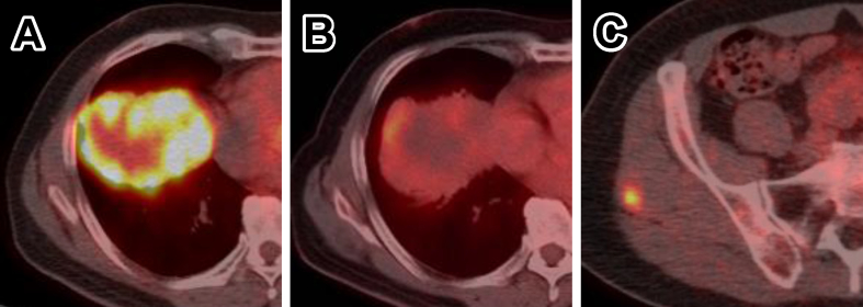 Fig. 2