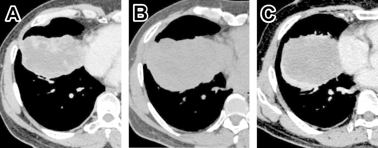 Fig. 1