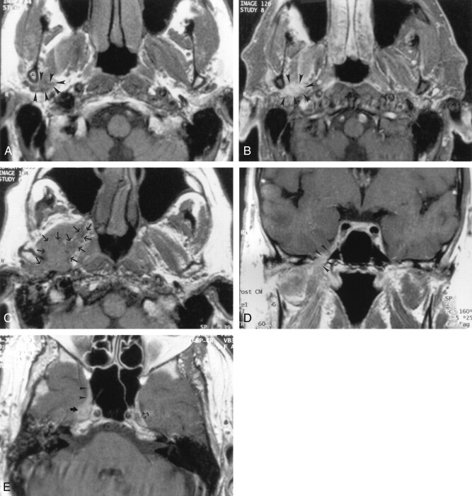 Fig 5.