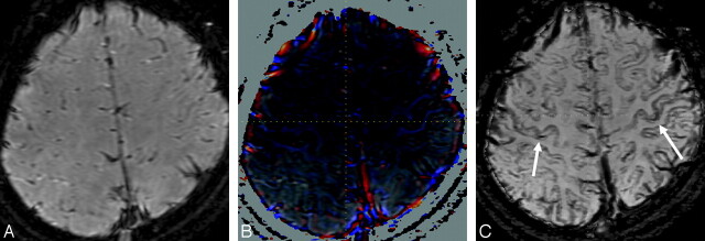 Fig 3.