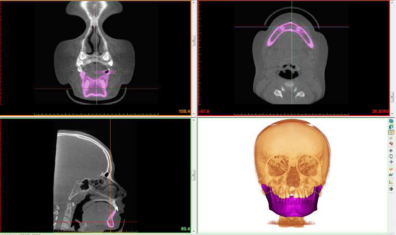 Fig. 2