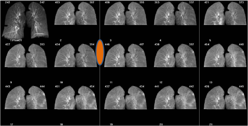 Figure 3