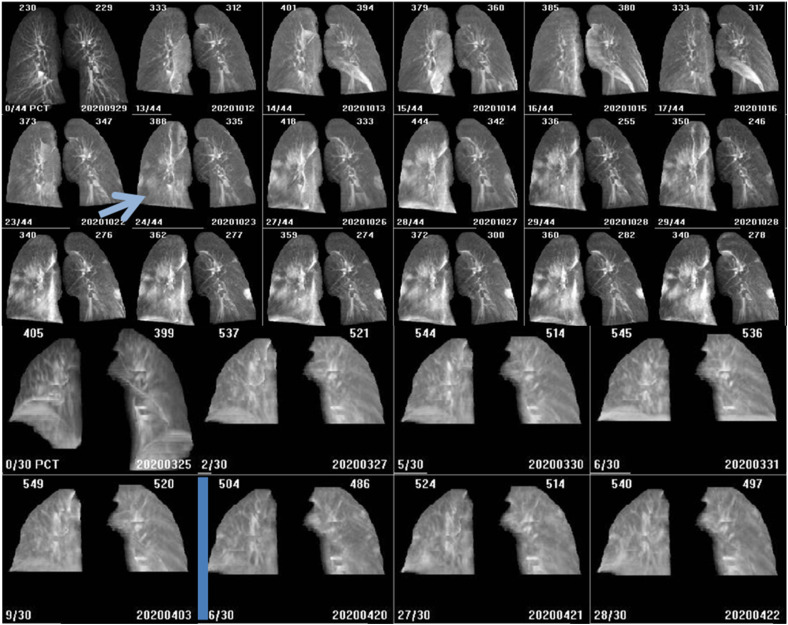 Figure 2